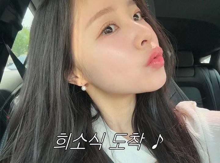 “볼 패임마저 담담하게”…이솔이, 암 투병 근황 고백→팬들 응원 쇄도