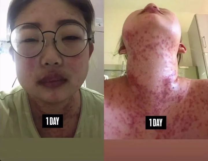 “47kg 감량 후 거울 속 나를 사랑”…최준희, 루프스 극복→자존감 회복 고백