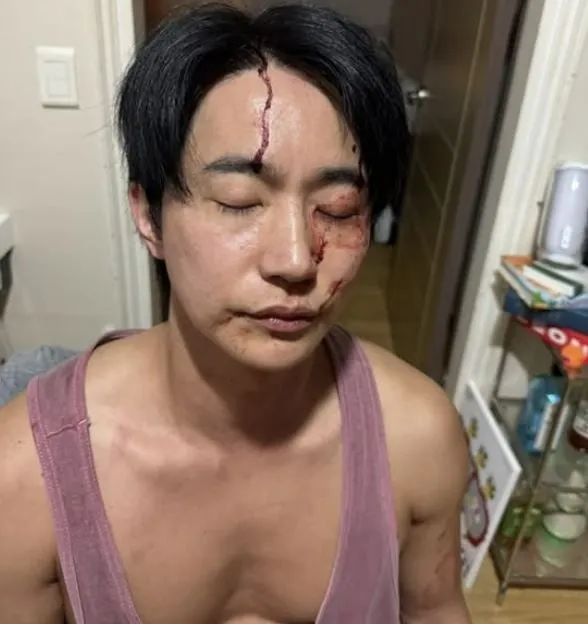 “억울함 속 침묵”…전호준, 전 여자친구 폭행·금전 논란→정면 반박