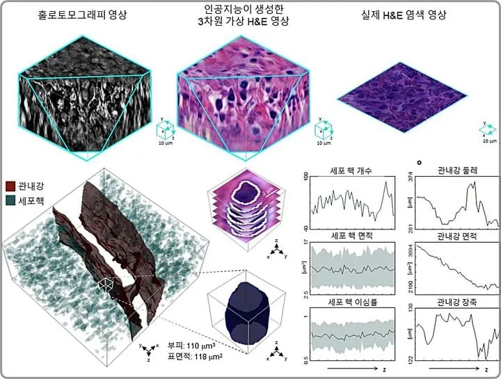 KAIST, 암조직 3D 가상염색 개척