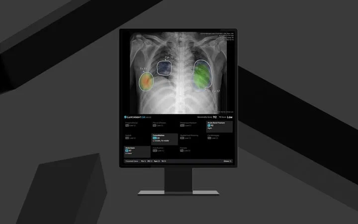 루닛 인사이트 CXR4, 유럽 CE MDR 획득…AI 의료기기 신뢰도 혁신→유럽시장 도약