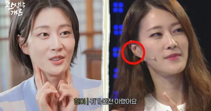 “돈 새는 관상 충격”…이현이, 귀 필러 고백→박성준 진단에 웃음