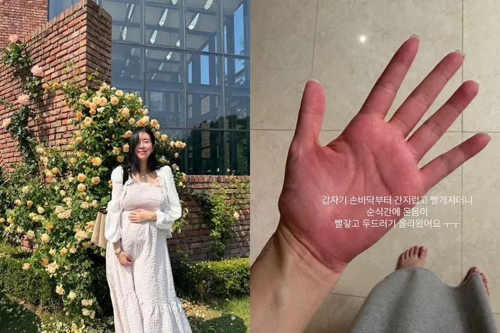 “쌍둥이 임신 중엔 매일이 고비”…김지혜, 항생제 부작용→응급실 사투