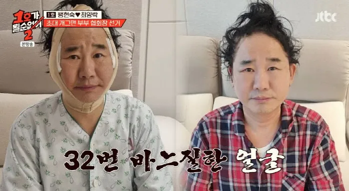 “수술 고백에 탄식”…최양락, ‘1호가 될 순 없어2’서 리얼 폭로→현장 술렁
