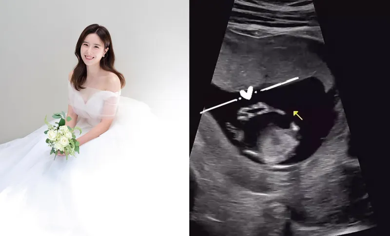 박가령 인스타그램