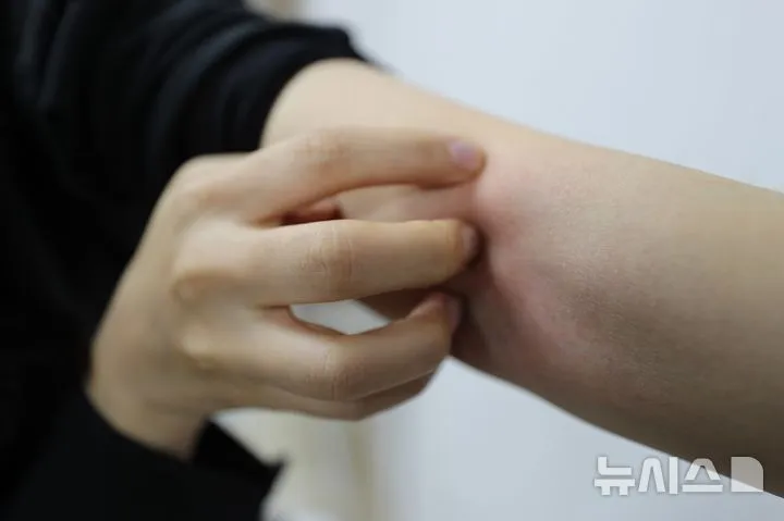 알레르겐 특이적 조절 T세포 규명