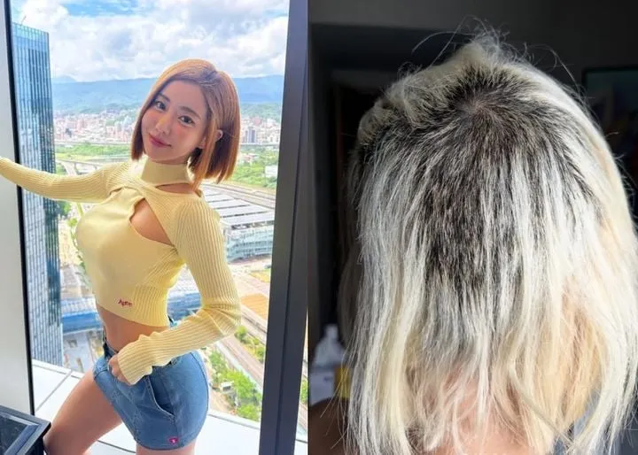 “머리카락이 한순간 사라졌다”…DJ소다, 탈색 사고 고백→투혼의 각오와 눈물