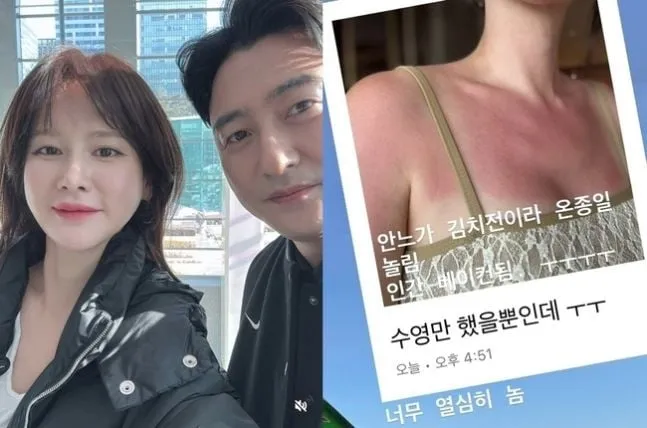 “인간 베이컨 됐다”…이혜원, 일광화상 호소→안정환의 농담 ‘웃픈 휴가’