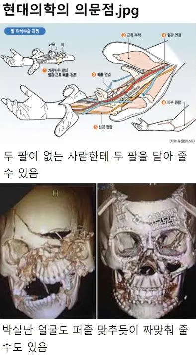 머리를 통째로 이식하는 수술까지도 성공한 현대 의학이 손도 못대고 있는 영역
